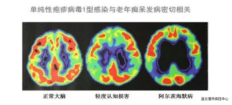 http://www.chinacdc.cn/jkzt/ymyjz/ymlbgd/201610/W020161018550845452970.jpg